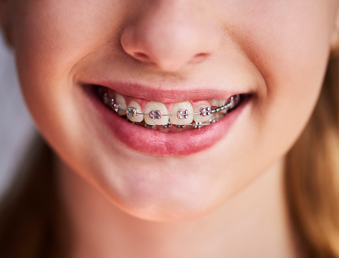 Orthodontic Treatment Options - Call Today 855-614-5221 - California ...