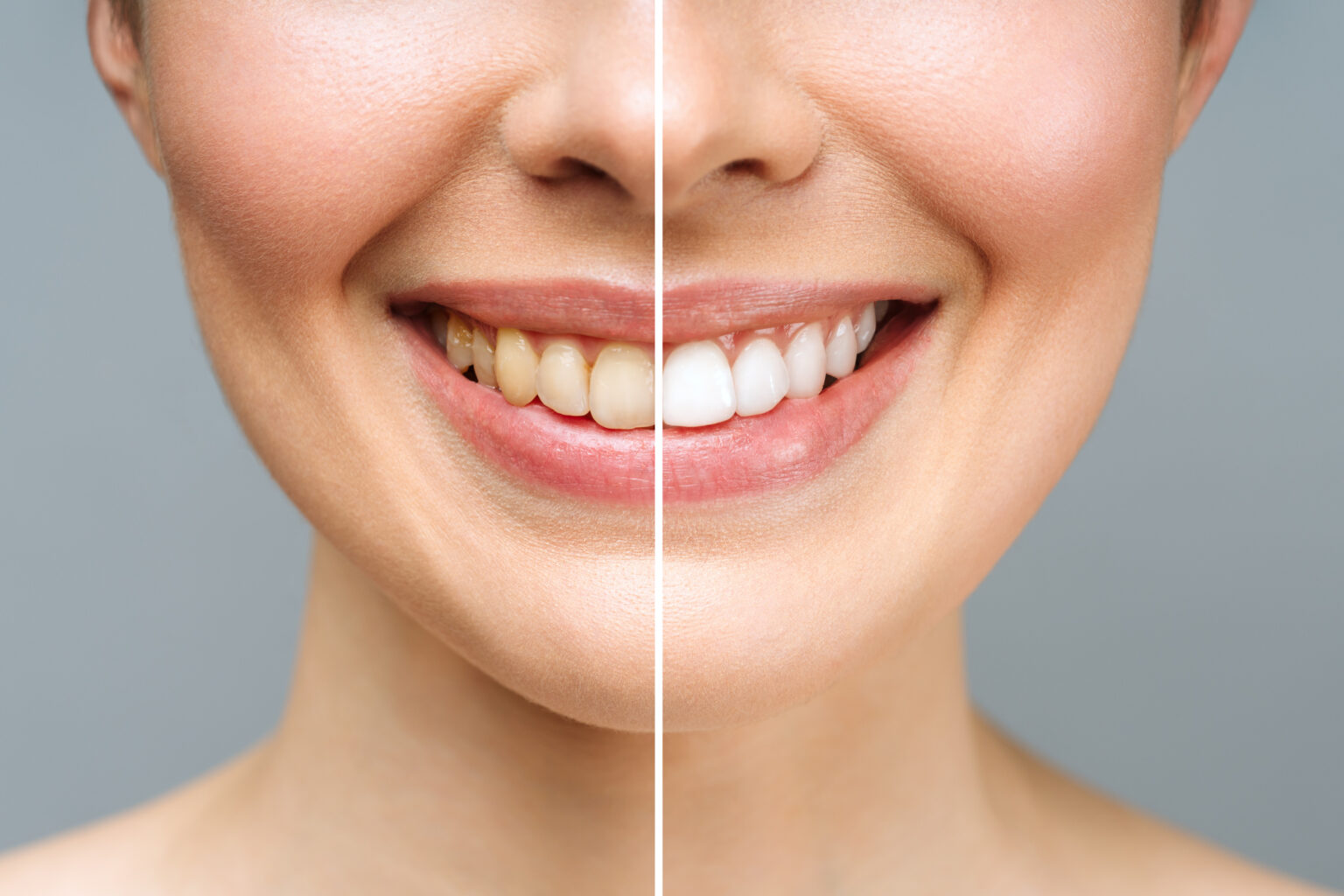 The Bright Path To A Whiter Smile Pre Whitening Dental Care Essentials